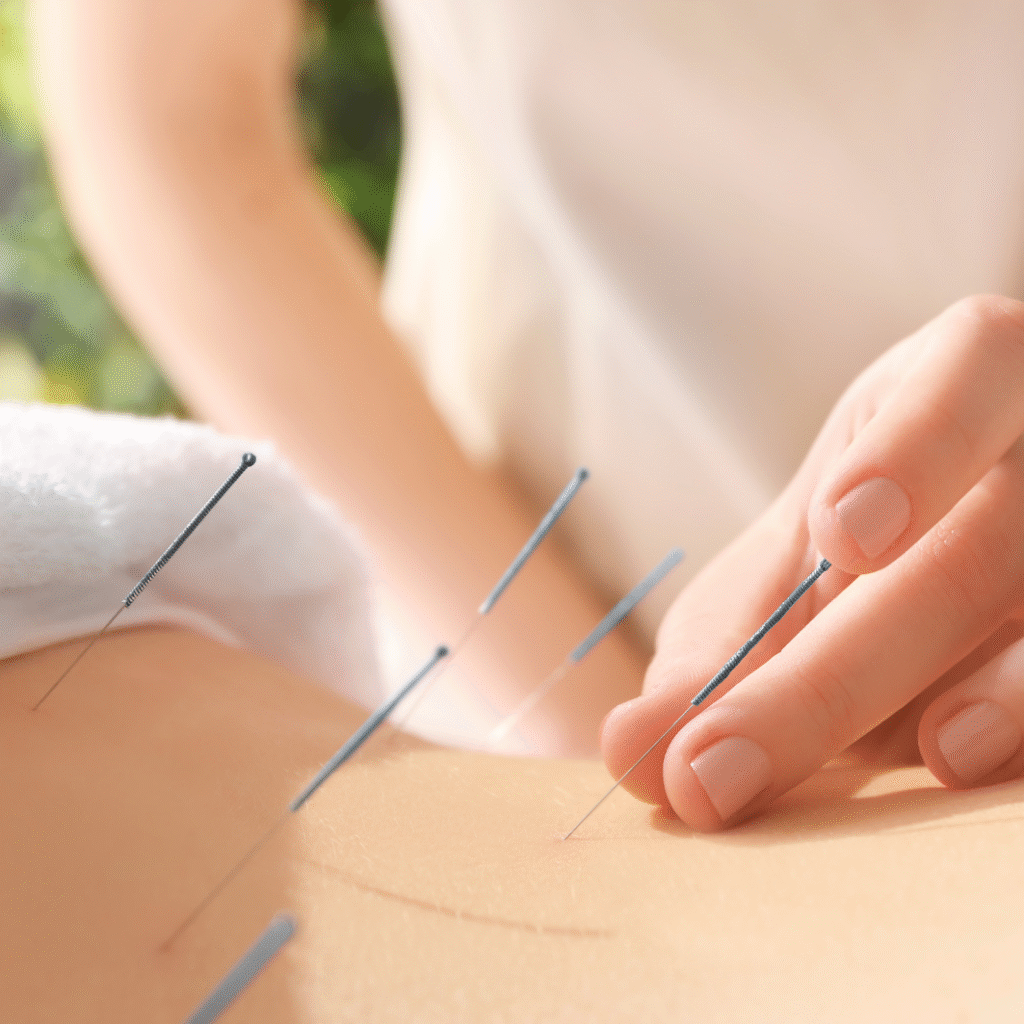 acupunctuur bij vrouwen - voorbeeld